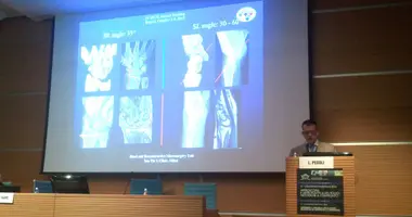 SHORT INTERVIEW AT THE ITALIAN HAND SURGERY NATIONAL MEETING
