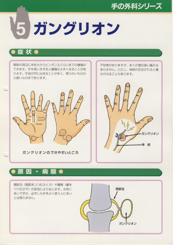 手根管症候群 Chirurgia Della Mano Dr Loris Pegoli